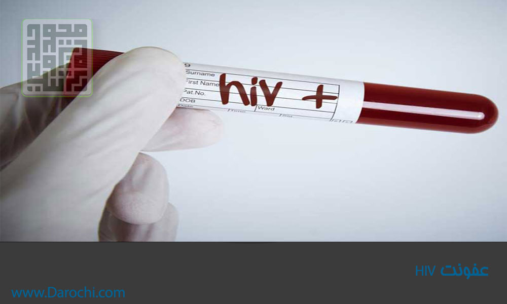 عفونت-HIV
