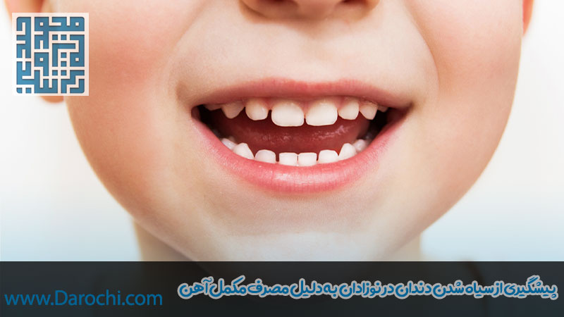 پیشگیری از سیاهی دندان بعد از مصرف قطره آهن