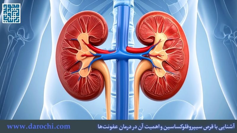 آشنایی با قرص سیپروفلوکساسین و اهمیت آن در درمان عفونت‌ها