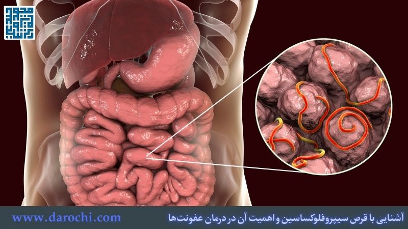 آشنایی با قرص سیپروفلوکساسین و اهمیت آن در درمان عفونت‌ها