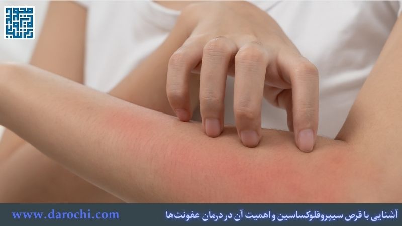 آشنایی با قرص سیپروفلوکساسین و اهمیت آن در درمان عفونت‌ها