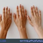 روش های کاهش ملانین و روشن کردن دائمی پوست سبزه