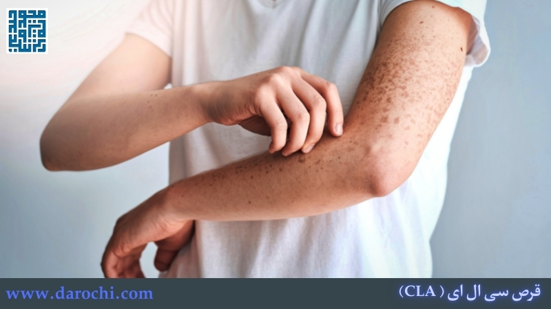 عوارض قرص سی ال ای