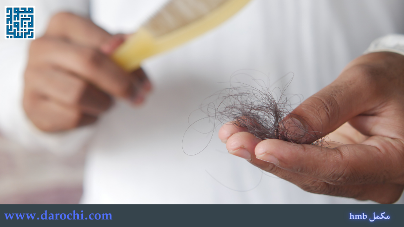 اچ ام بی و ریزش مو