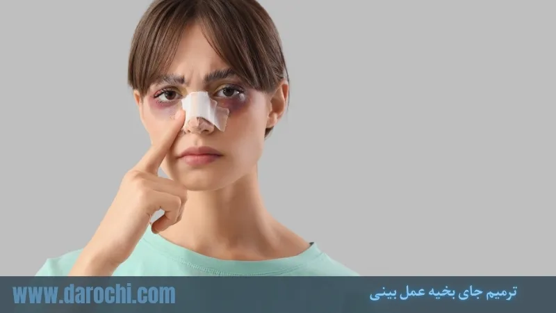 ترمیم جای بخیه عمل بینی - از بین بردن جای بخیه، زمان ترمیم و بهترین روش‌های درمان